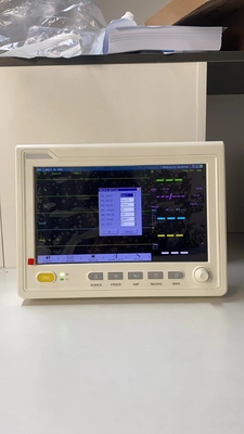 医療 10.1 インチ 患者モニター ポータブル マルチパラメータ 患者モニター