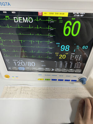ECG SPO2 NIBP TEMP RESP 携帯ベッドサイドモニター ETCO2-Class II 1 年間の保証